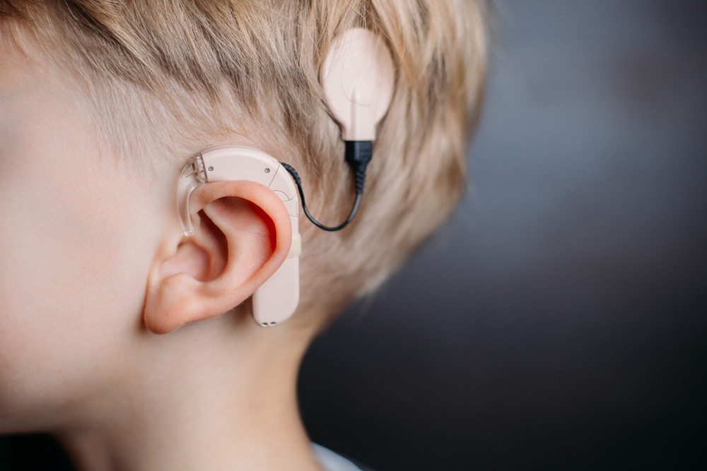 Peshawar launches cochlear implant programme for hearing-impaired children