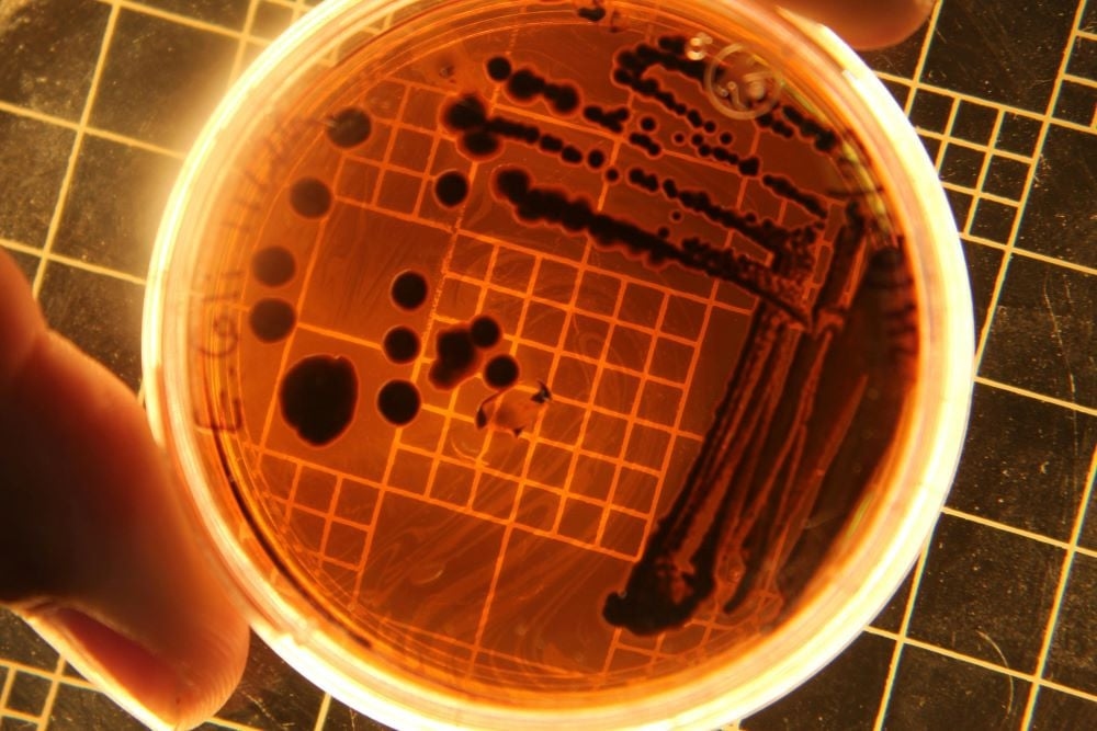 E.coli can turn plastic into painkillers, chemists discover