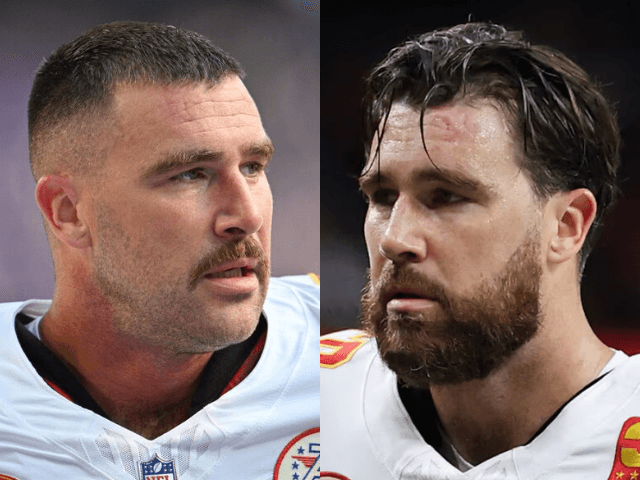 Travis Kelce's barber breaks silence on NFL star's hair transplant rumours