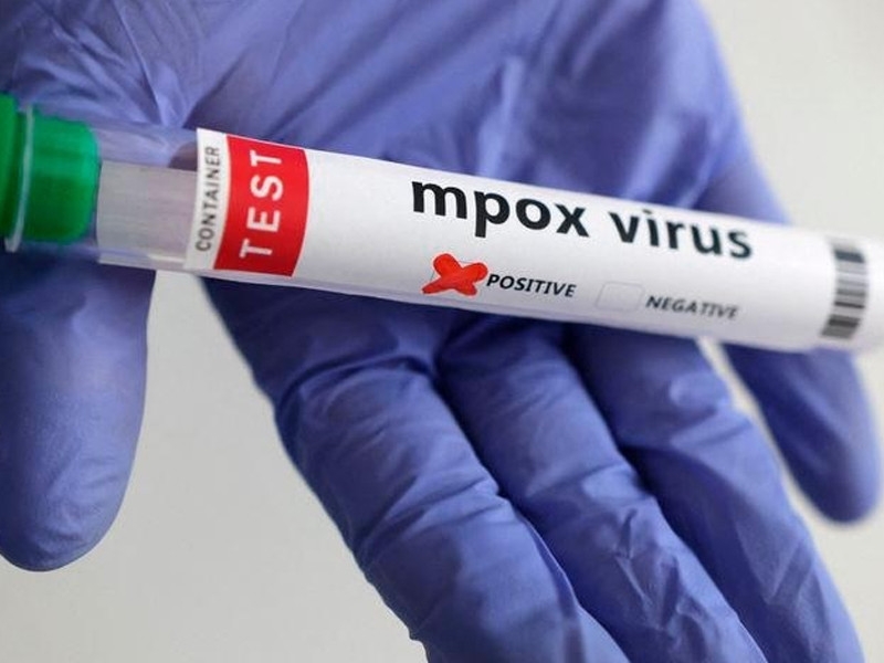 First confirmed case of Mpox reported
