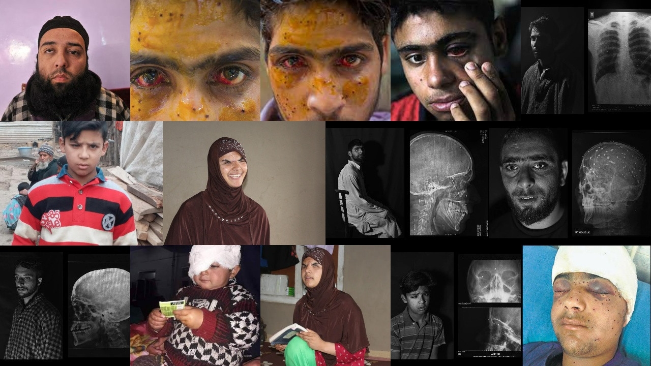 India's war on Kashmir's eyesight