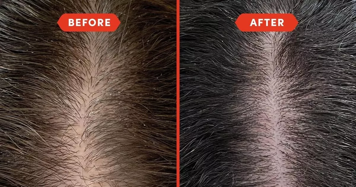 Amazon users 'blown away' by £27 hair growth oil that works 'in a few weeks'