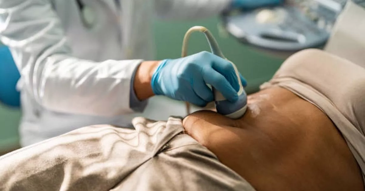'Striking' discovery that may shed light on bowel cancer spike in young people