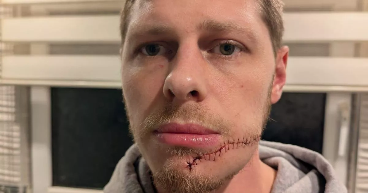 Musician scarred for life in horror slashing attack after masked stranger storms stage
