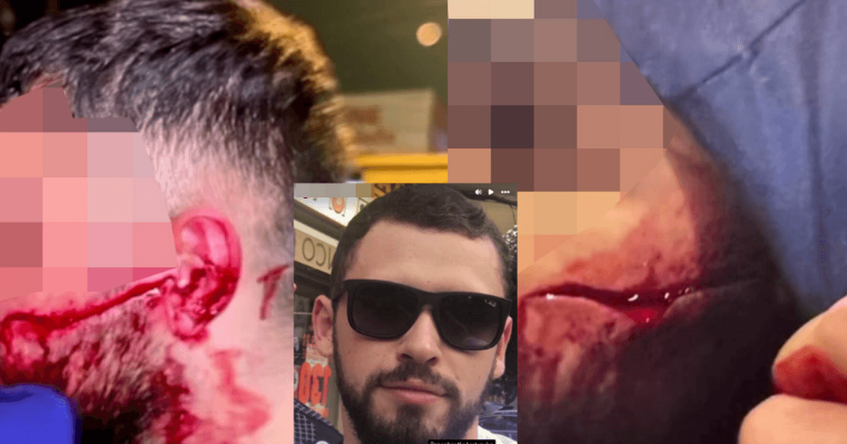 Gangster who sparked Scotland's violent drug war pictured after brutal revenge slashing