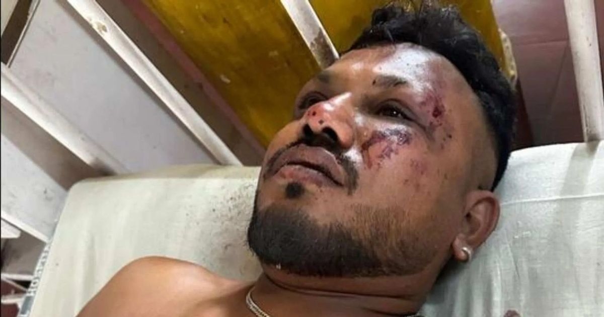 Miracle Air India crash passenger from UK survives fireball that killed hundreds