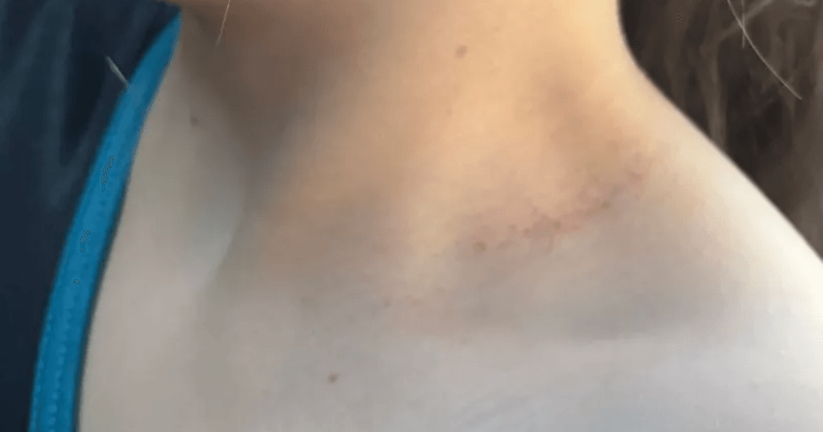 Scots mum fears as boy 'tries to strangle her daughter' at primary school