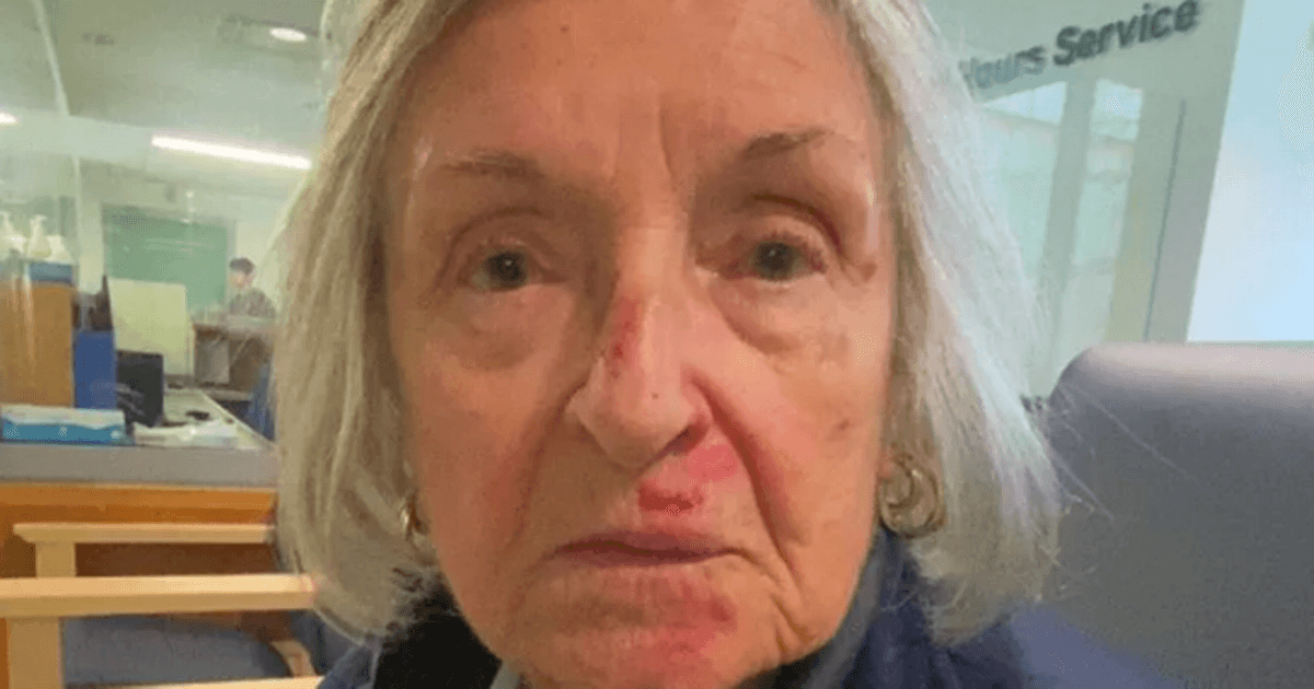 Gran left shaken and too scared to go out alone after horror fall at shopping centre