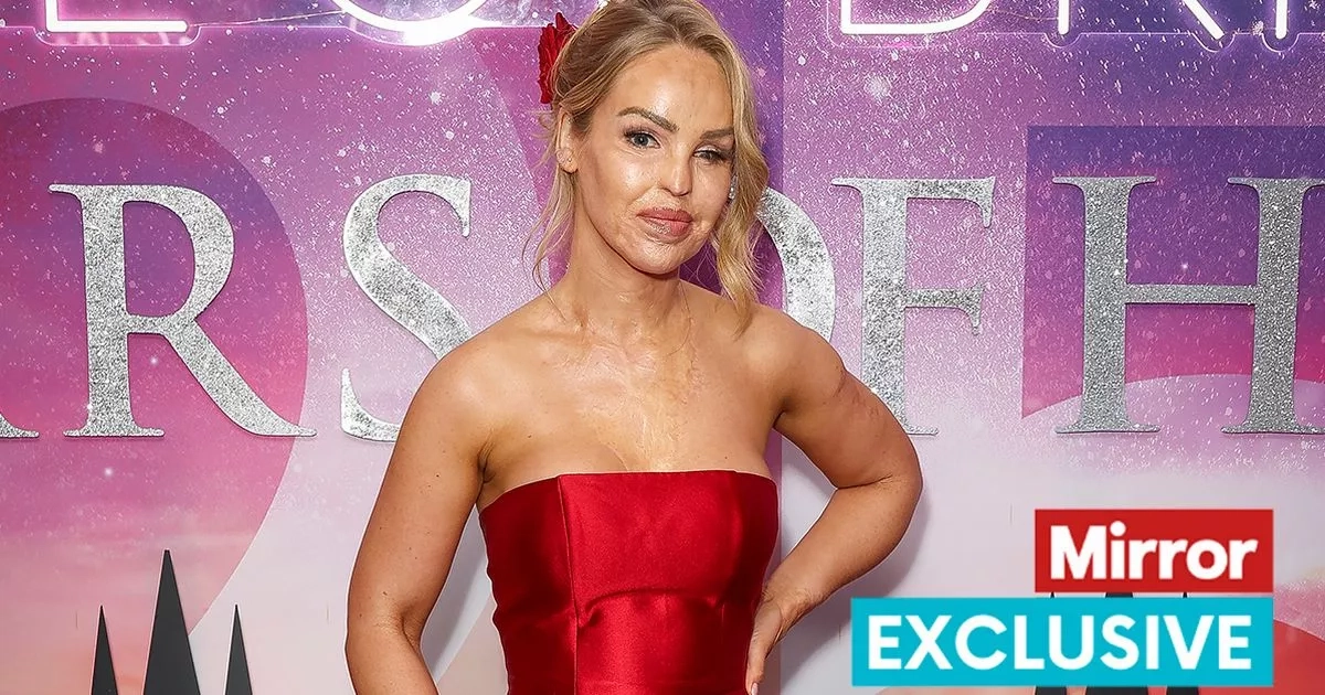 Acid attack robbed Katie Piper of chance to have third baby