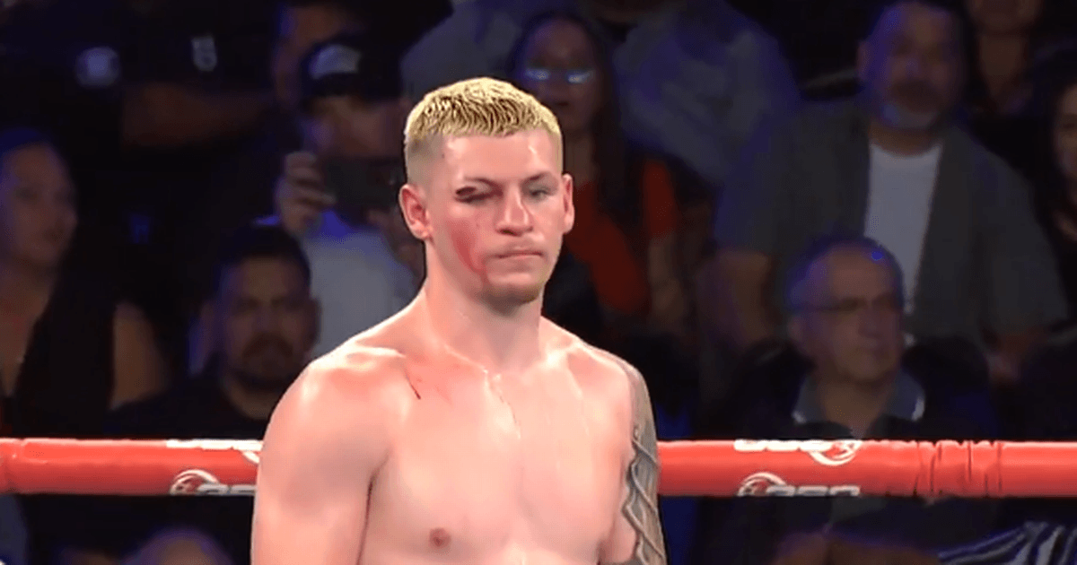 Callum Walsh fight stopped by doctor as Irishman suffers bad cut