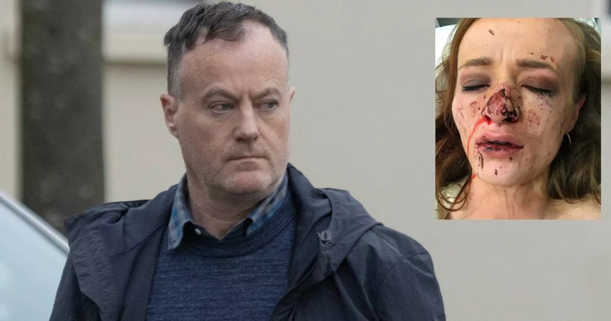 Quantity surveyor pleads guilty to assaulting young woman almost 10 years ago