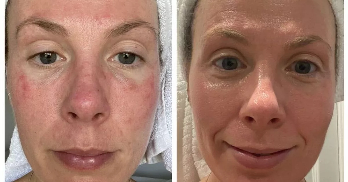Irish doctor's face cream wins fans for soothing redness and boosting glow