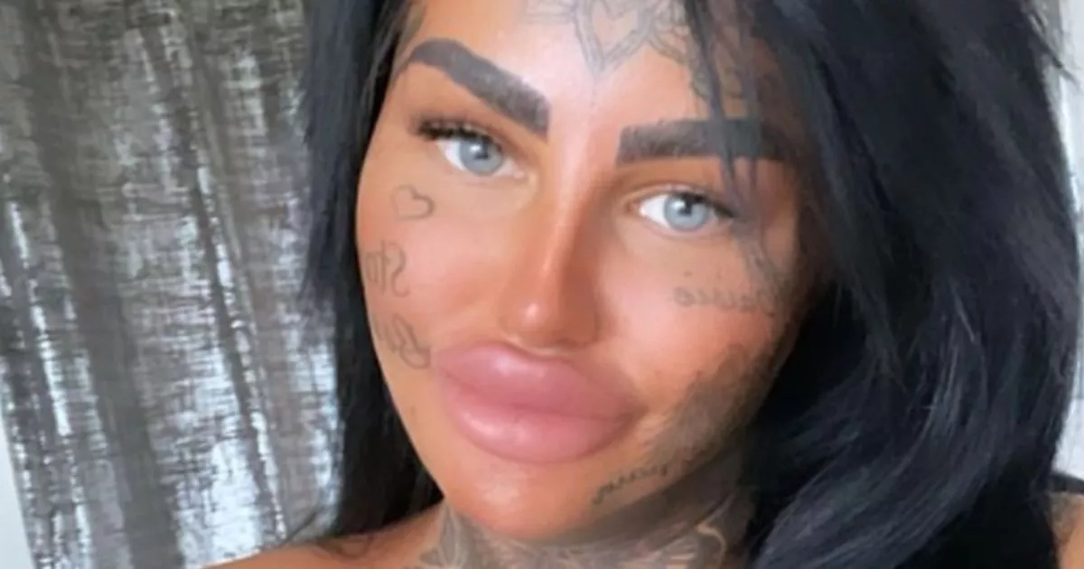 ‘Temu Katie Price' hits back at trolls after extreme filler tattoos