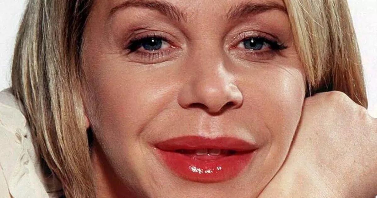 Leslie Ash unveils facelift after 'losing herself completely' over botched lips