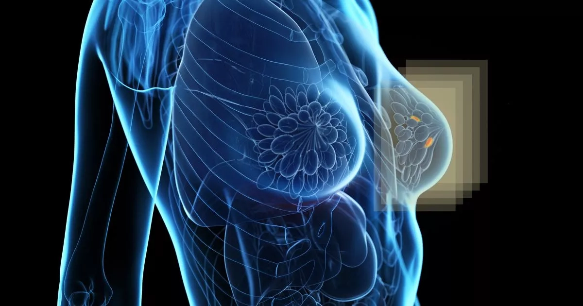 Breast cancer breakthrough as new super-fast scanner unveiled
