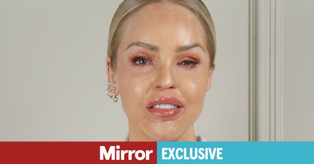 Katie Piper, 41, devastated over heartbreaking baby decision
