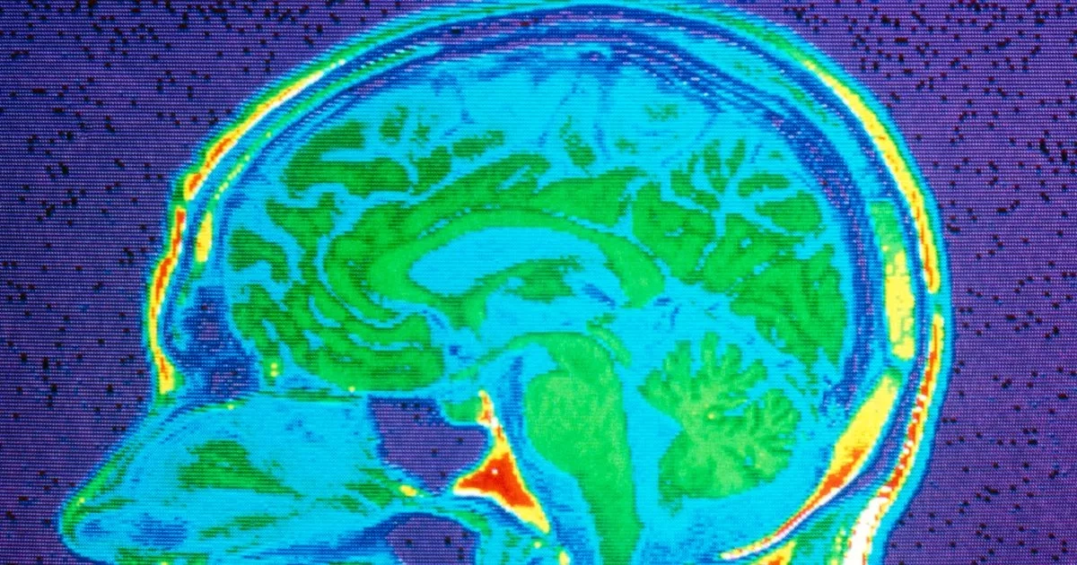 Cognitive decline and ageing occur 'more rapidly' among people with one health issue