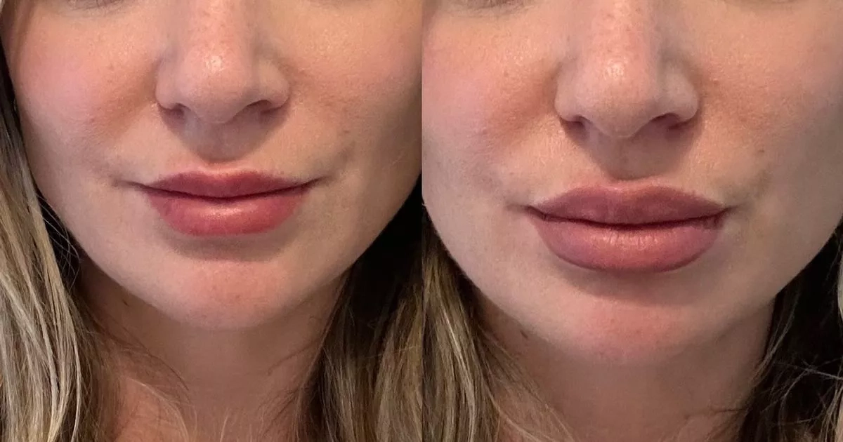 'Charlotte Tilbury's new double-ended lip liner makes my lips look like they have filler'