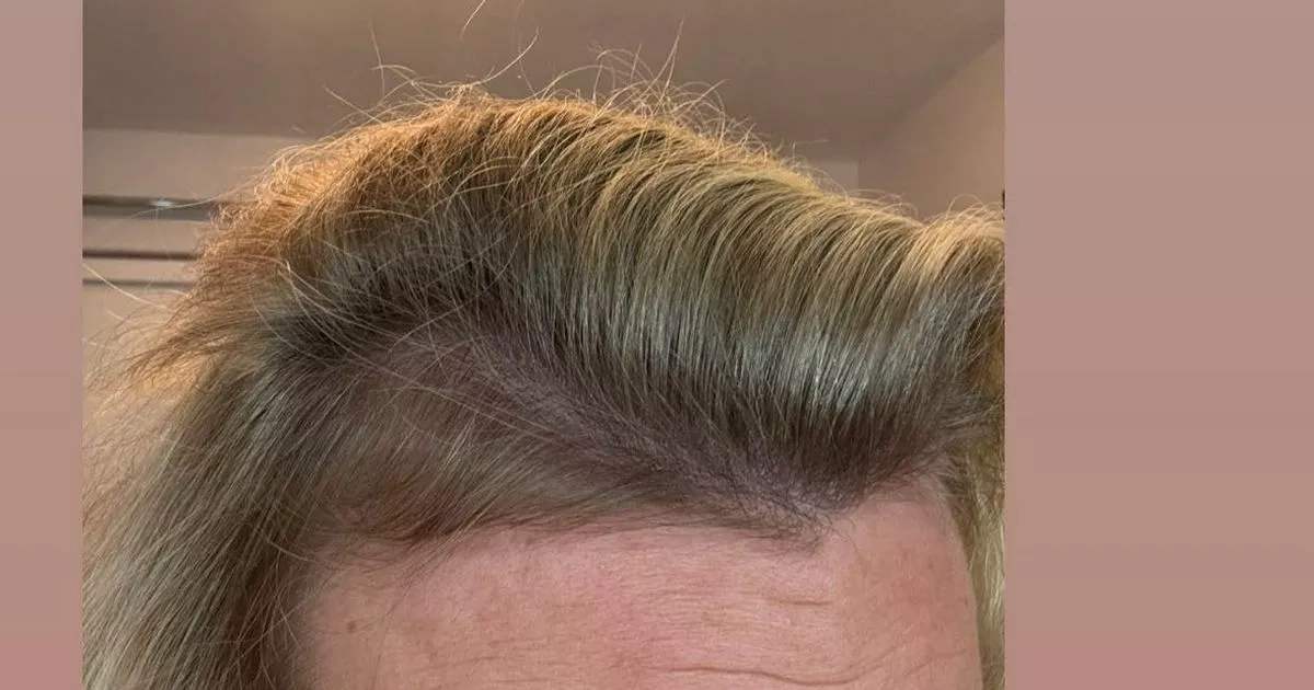 ‘Miracle cure' hair growth supplement makes ‘unbelievable difference' to its thickness