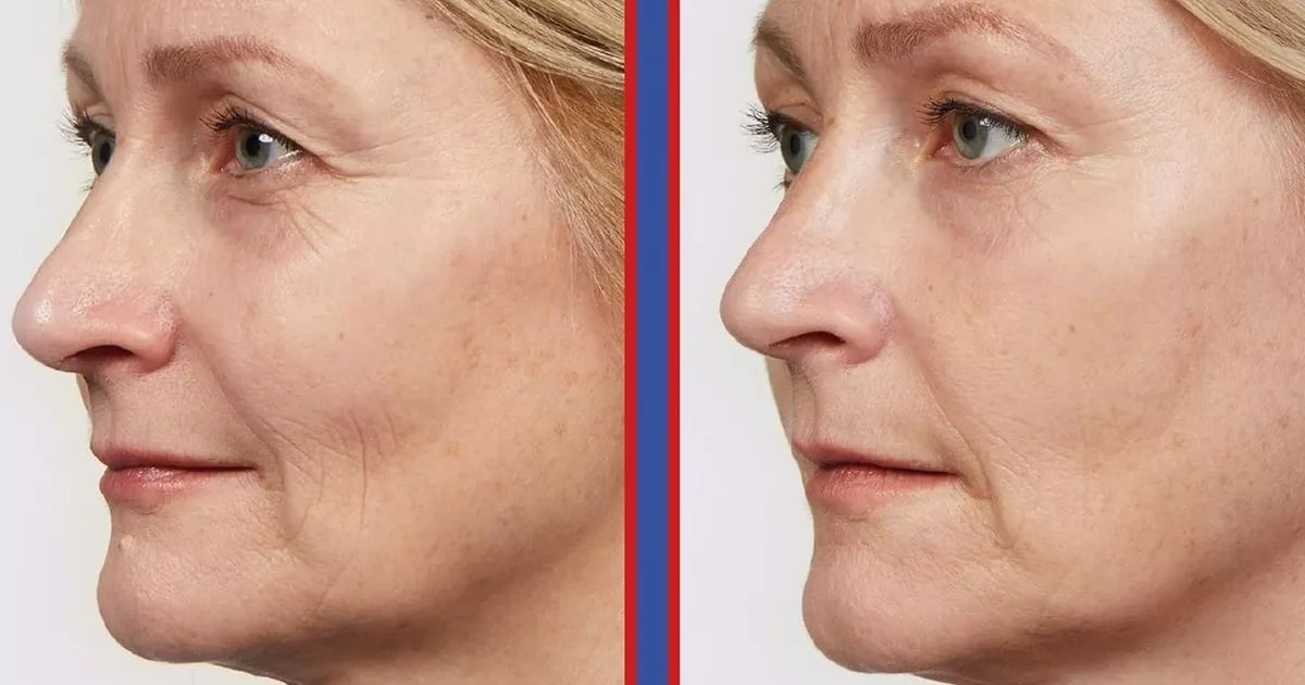Best-selling £32 anti-ageing serum that makes ‘skin look younger' is now £14 in flash beauty sale