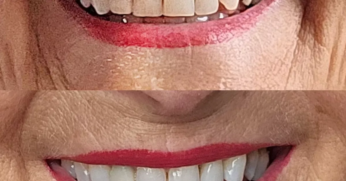 Shoppers dub new teeth whitening kit a 'miracle' for removing stains in 'days'