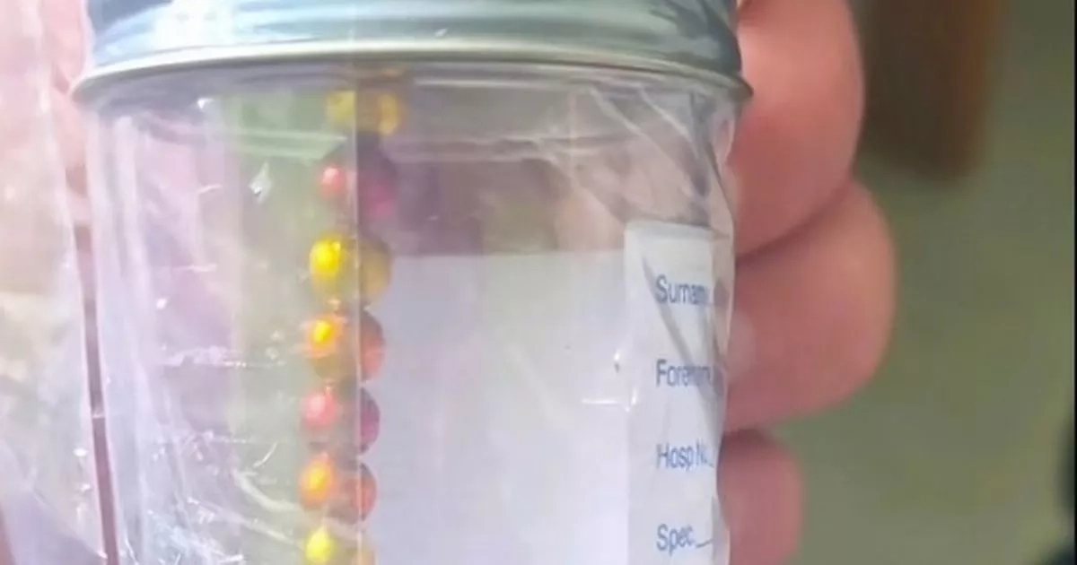 Hundreds of children hospitalised amid terrifying magnet trend sweeping UK