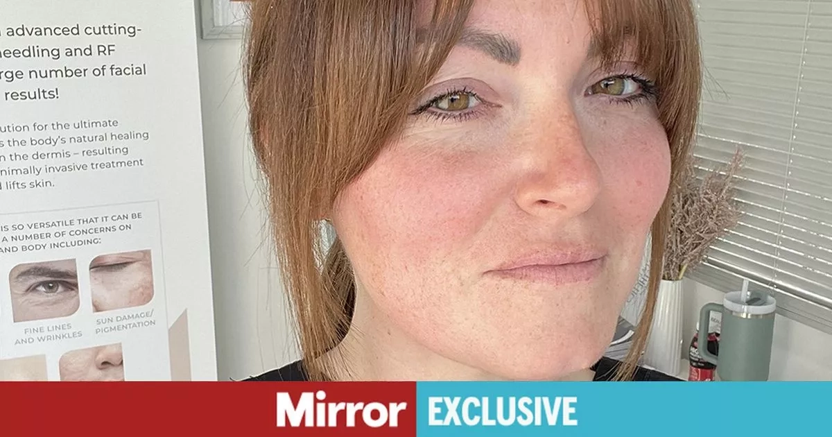 'Hairdresser saved my life after I took huge risk with my teen suntan obsession'