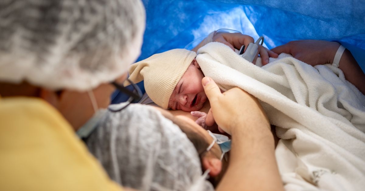 'I had an unplanned C-section - my partner keeps saying I took the easy way out'