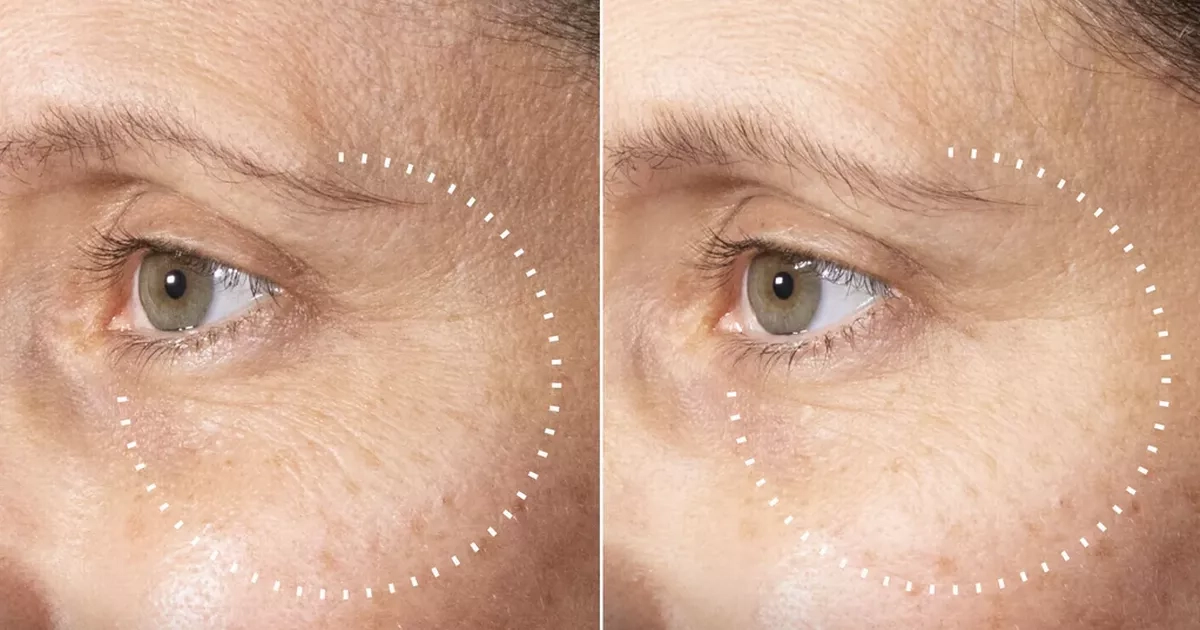 Shoppers say new Medik8 buy made skin visibly brighter in days