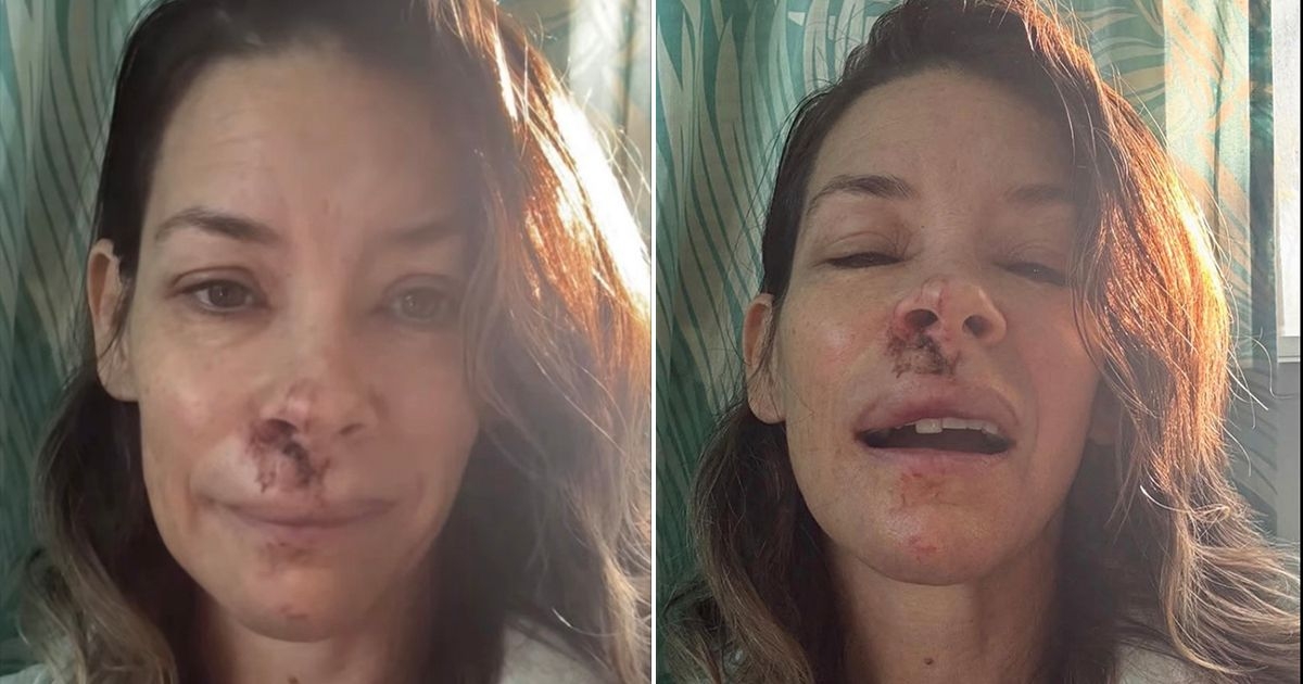 Marvel star's gruesome injuries after horror boulder ordeal left her in hospital