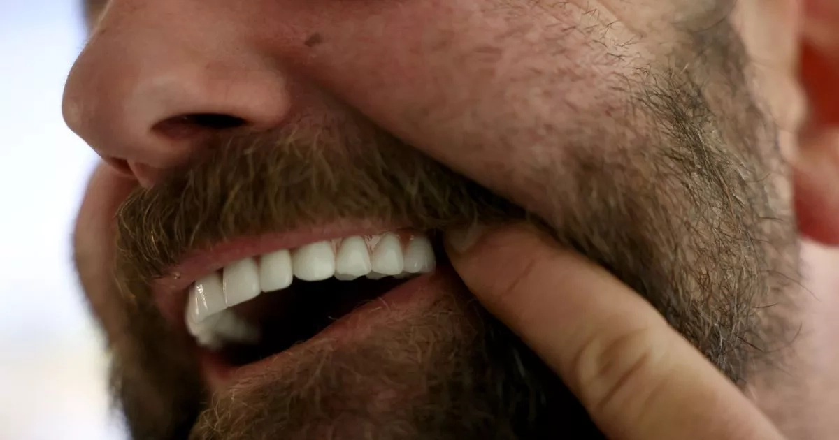'Turkey teeth' are leaving Brits toothless and in pain but dentists can't help