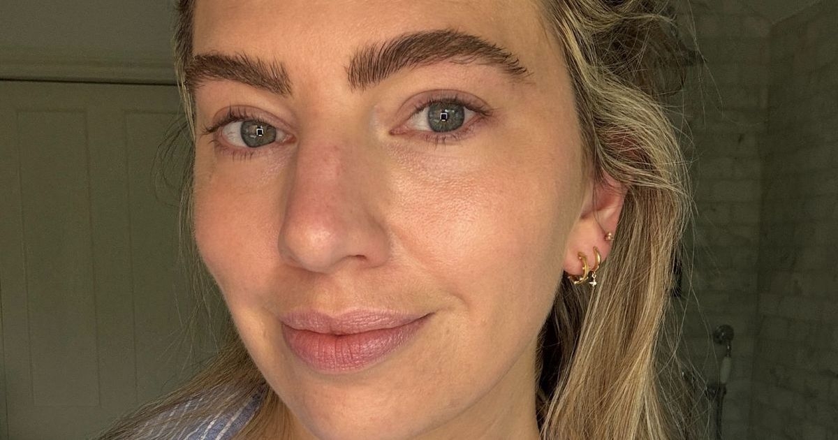 ‘This new vitamin C serum is the only one that doesn't irritate my problem skin'