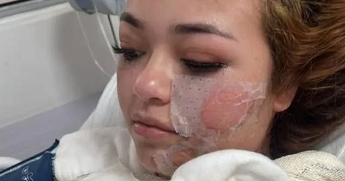 Young mum dies after passing out in hot tub and waking up to skin peeling off