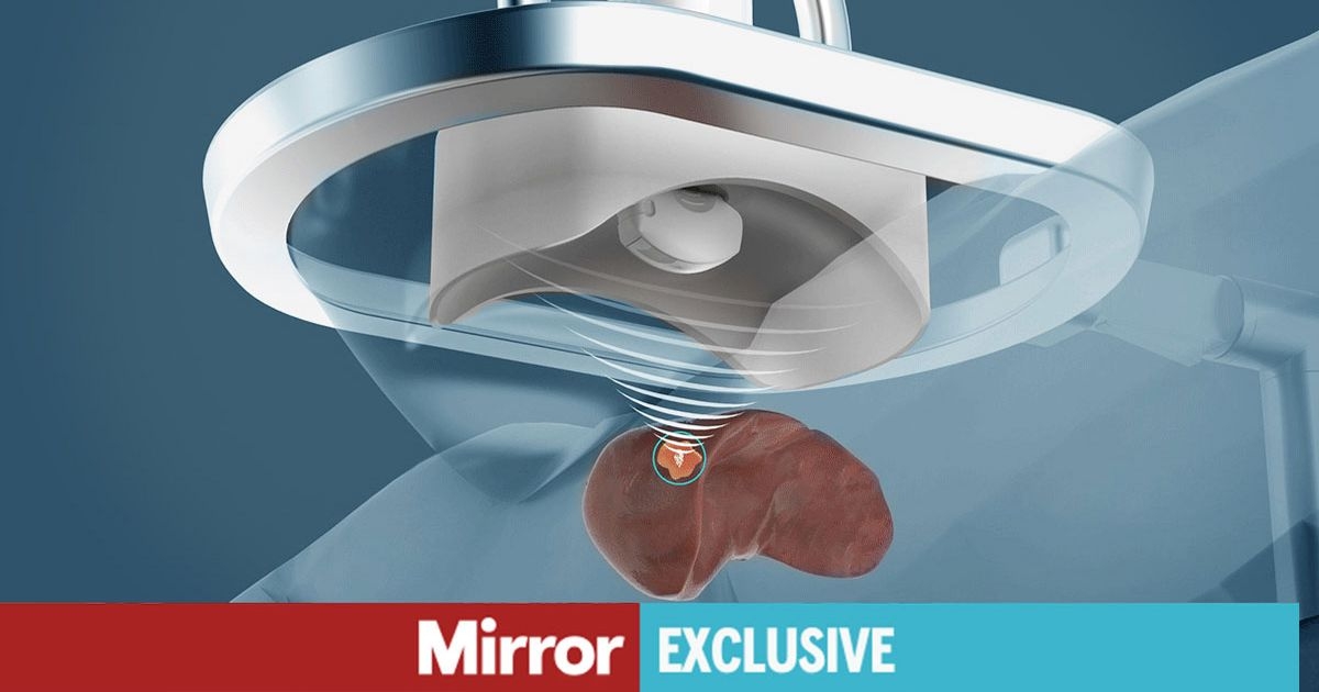 New ‘Star Wars' cancer treatment which pulverises tumours with sound waves