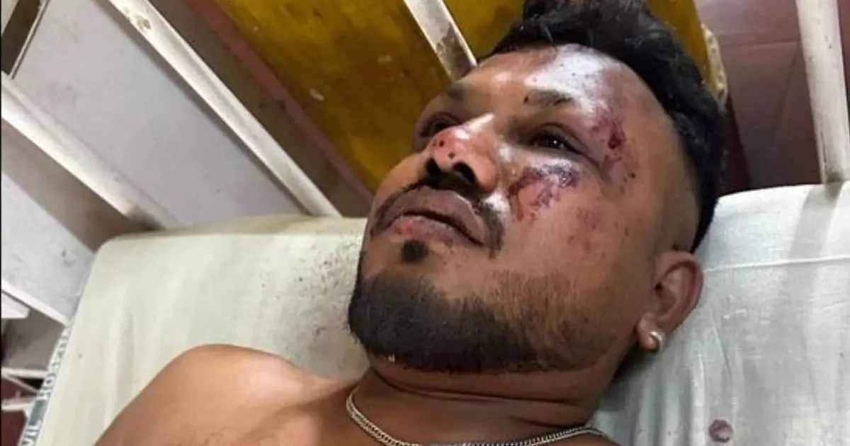 Air India crash survivor ran from fiery wreckage as brother 'died on scene'