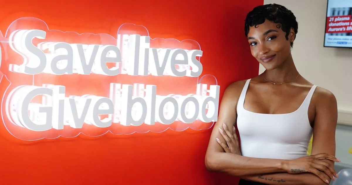 Jourdan Dunn calls on Black blood donors to help with painful genetic condition