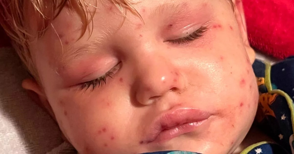 Toddler fighting for his life after being stung 150 times in horror wasp swarm