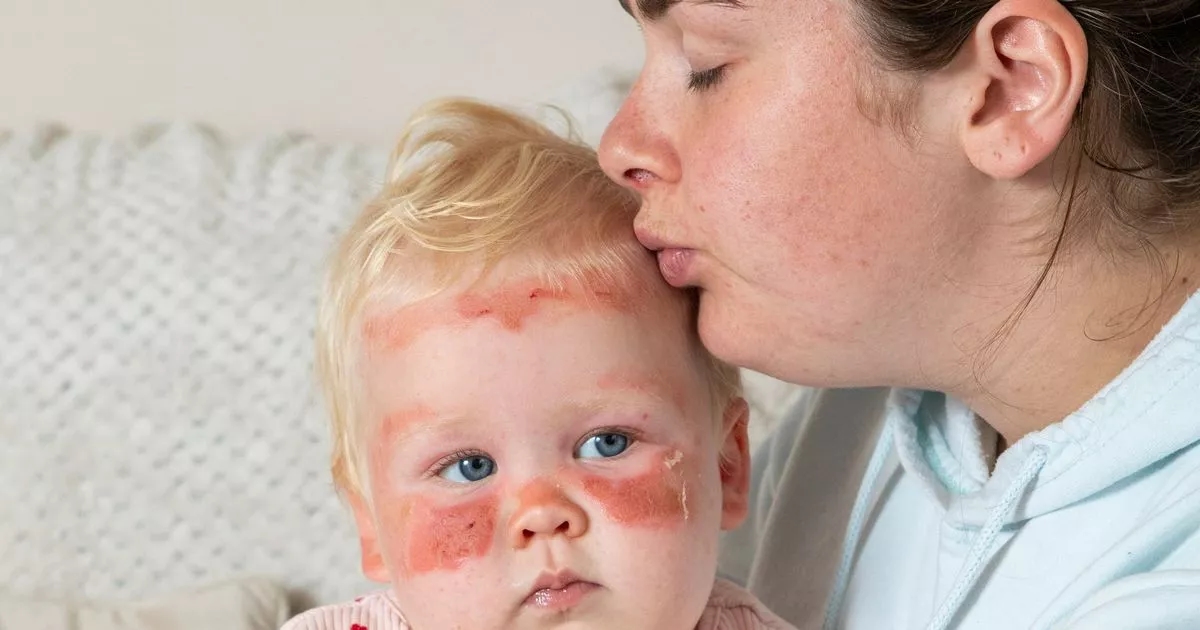 'My baby got sunburnt in three hours, in Scotland - I won't make same mistake'