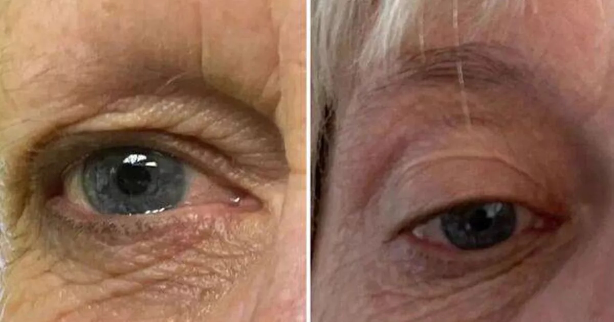 Beauty fans wowed by award-winning brow serum that gives 'thicker' arches