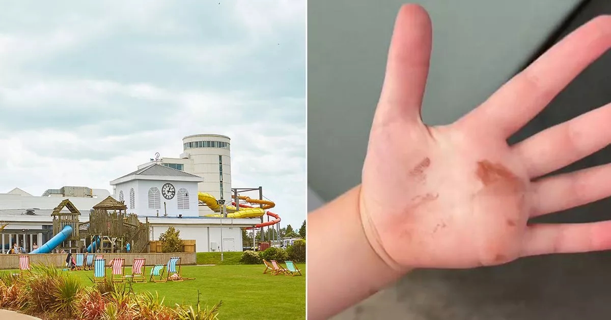 Mum leaves Butlins after ONE night after 'beds were wet' and daughter had 'poo on hands'