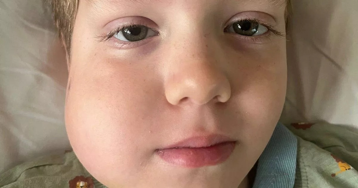 'Our son had a wobbly tooth before aggressive disease diagnosis - listen to your child'