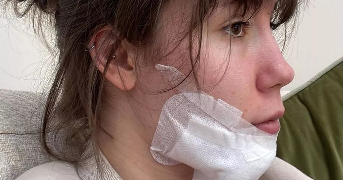 'I was told lump was a cosmetic issue - now I've had my chin rebuilt'