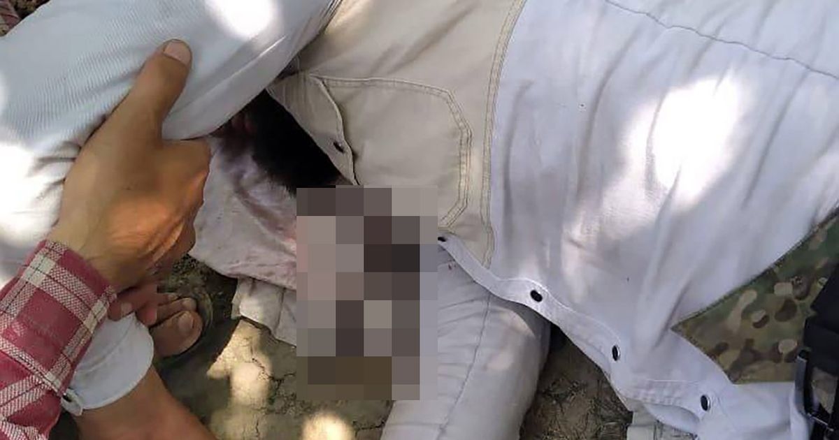 Miracle man survives iron stake plunging through body millimetres from heart