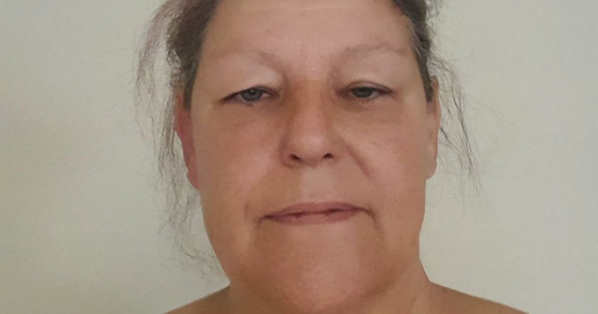 'I have nightmares over pocket bully dog attack which left me in hospital for days'