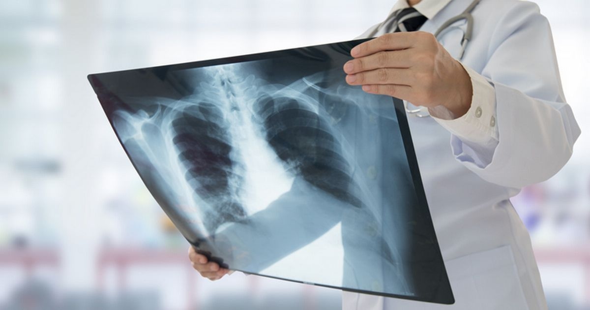 Radiographer banned from conducting X-rays on anyone under 18 for 12 months