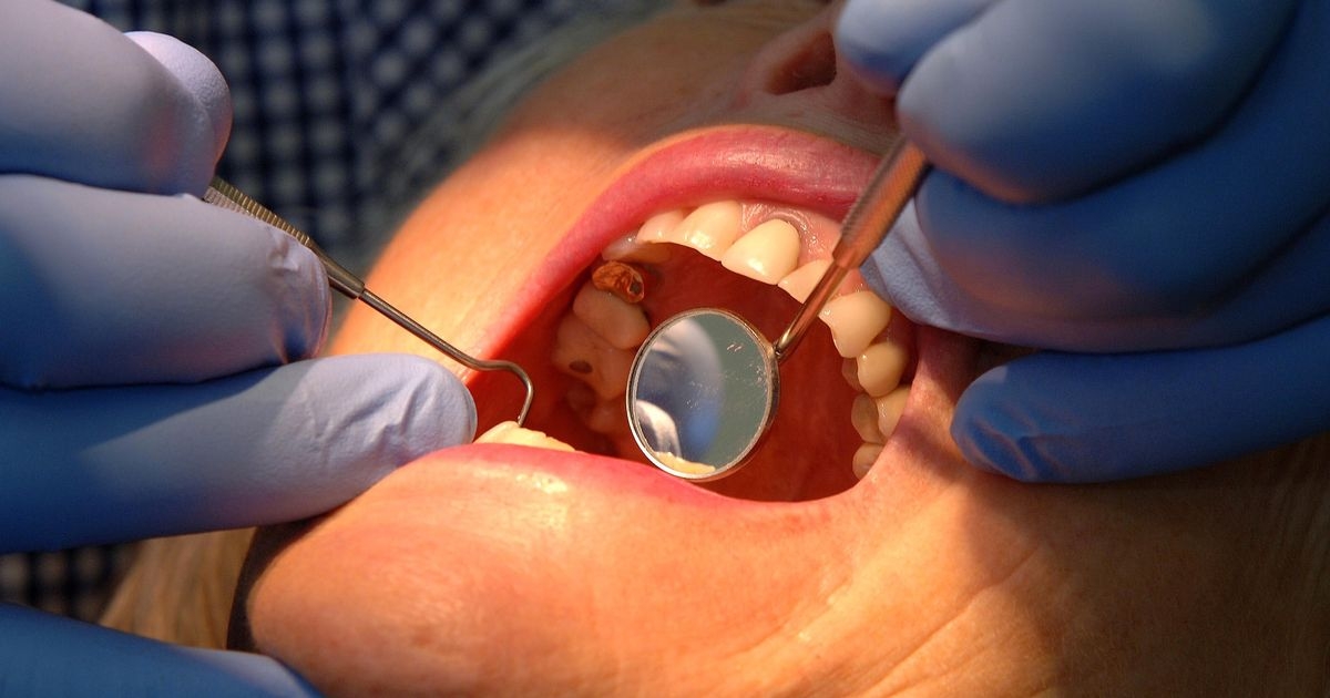 Warning Wales faces exodus of dentists and patients forced to go private