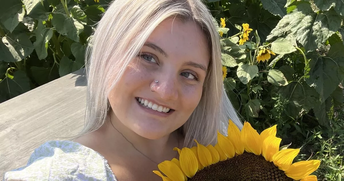 'I reacted to holiday sun so badly I looked like an alien'