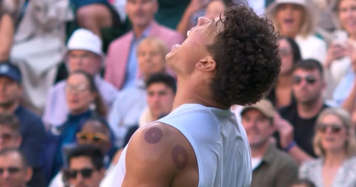 Clare Balding moves to explain strange markings on Wimbledon star's back
