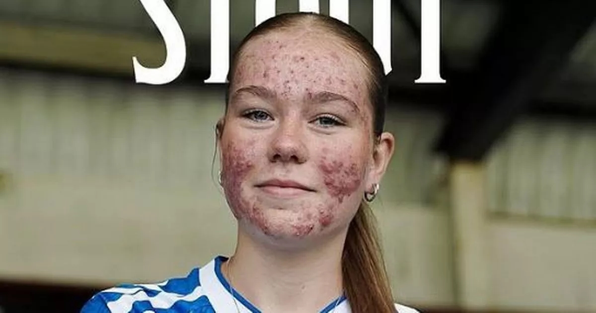 Teenage footballer ridiculed by online trolls as club pull big announcement