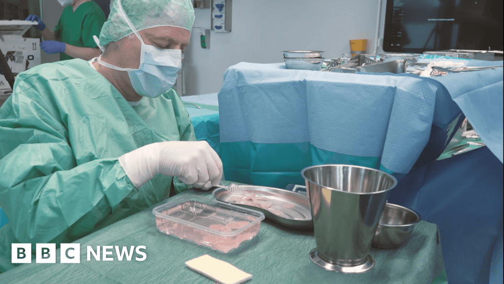Scientists trial implant to patch up the heart